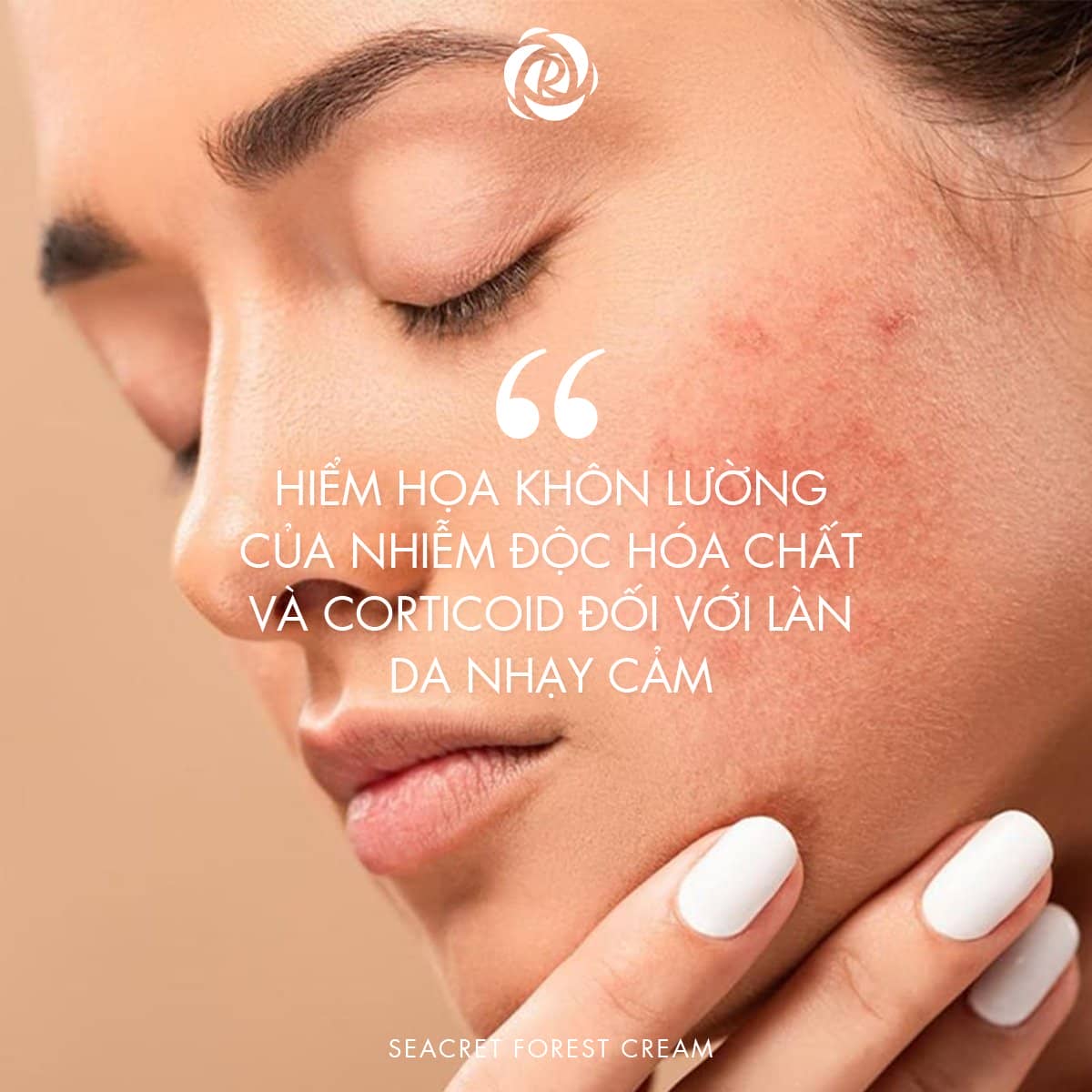 Hiểm họa khôn lường của da nhiễm độc hóa chất và corticoid